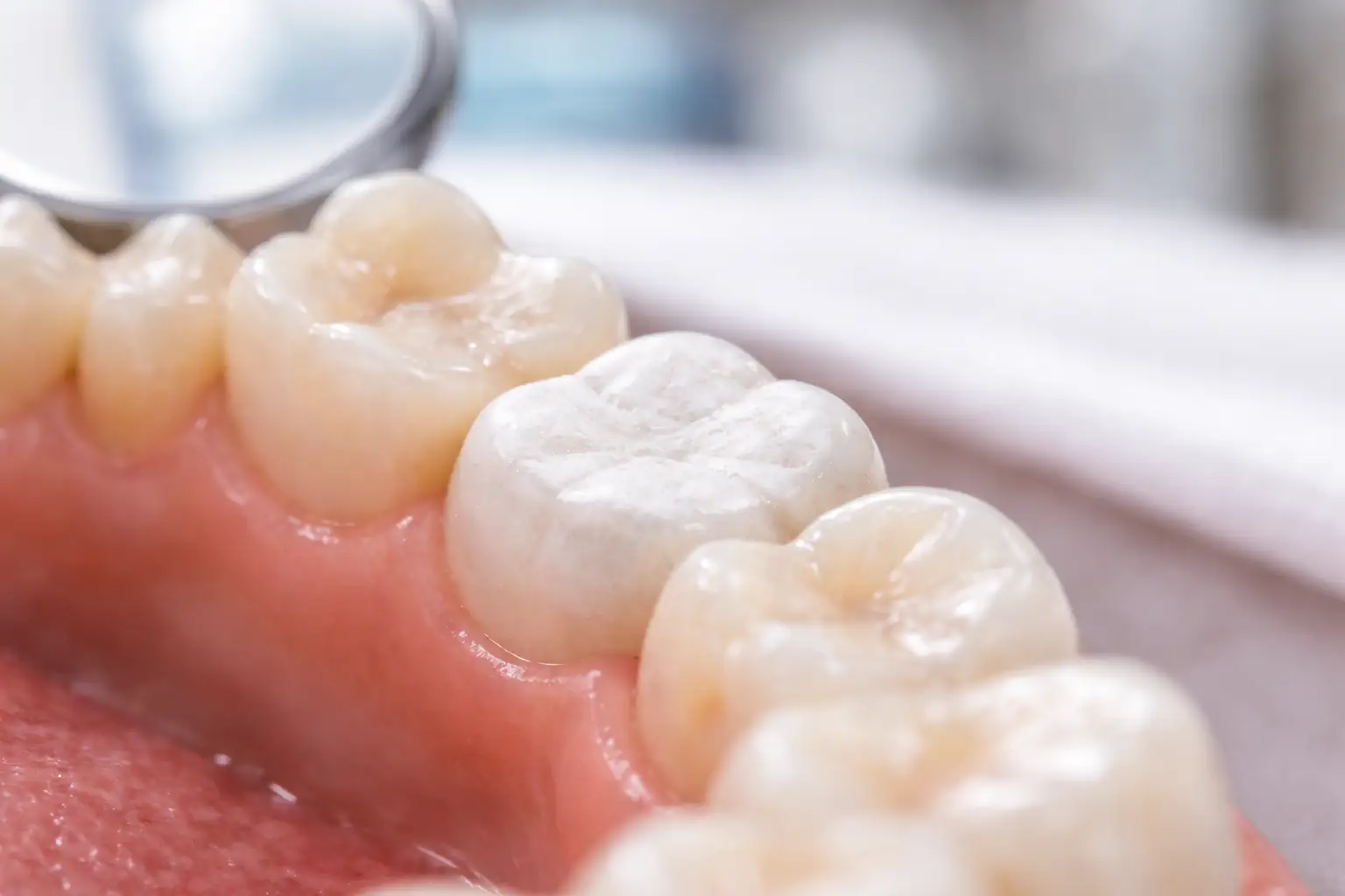 Pansement dentaire : goût dans la bouche, combien de temps ?