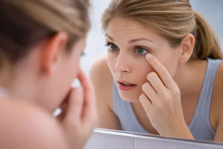 Personne examinant son œil au miroir après avoir reçu du parfum dans les yeux